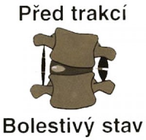 bolestivy_stav1.jpg